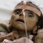 Yemen’de açlıktan dolayı 85 bin çocuk yaşamını yitirdi