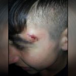 Ajanlaştırmayı reddedip röportaj veren 15 yaşındaki çocuk, polis tarafından tekrardan darp edildi