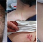 Valilikten köpekle işkenceye “köpek refleks gösterdi” açıklaması