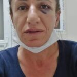 TJA üyesi Rojbin Çetin’e gözaltında işkence