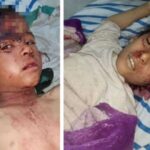 Minbic’te sivillere saldırı: 3’ü çocuk 6 ölü, 6 yaralı