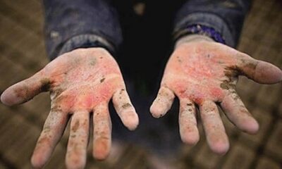 raw turkiyede 23 nisan cocuk isci sayisi 2 milyonu asti 483 bin kiz cocugu evli 834615965