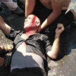 Akçakale’de çiftçilere saldırı: 2 yaralı, 7 gözaltı