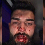 Dersim’deki işkenceyi görmezden gelen Tunceli Valiliği polisleri savundu