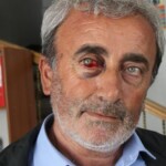 Batman’da işkence gören Yahya Karabaş yeniden gözaltına alındı